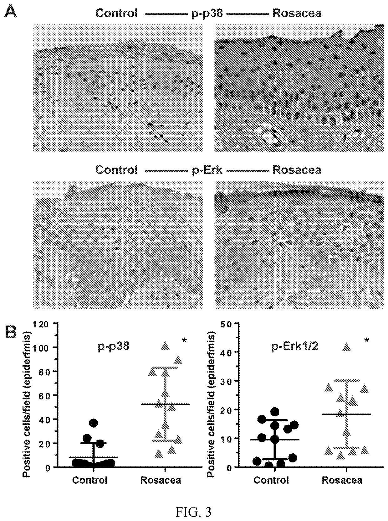 Treatment of rosacea with P38 and Erk kinase pathway inhibitors