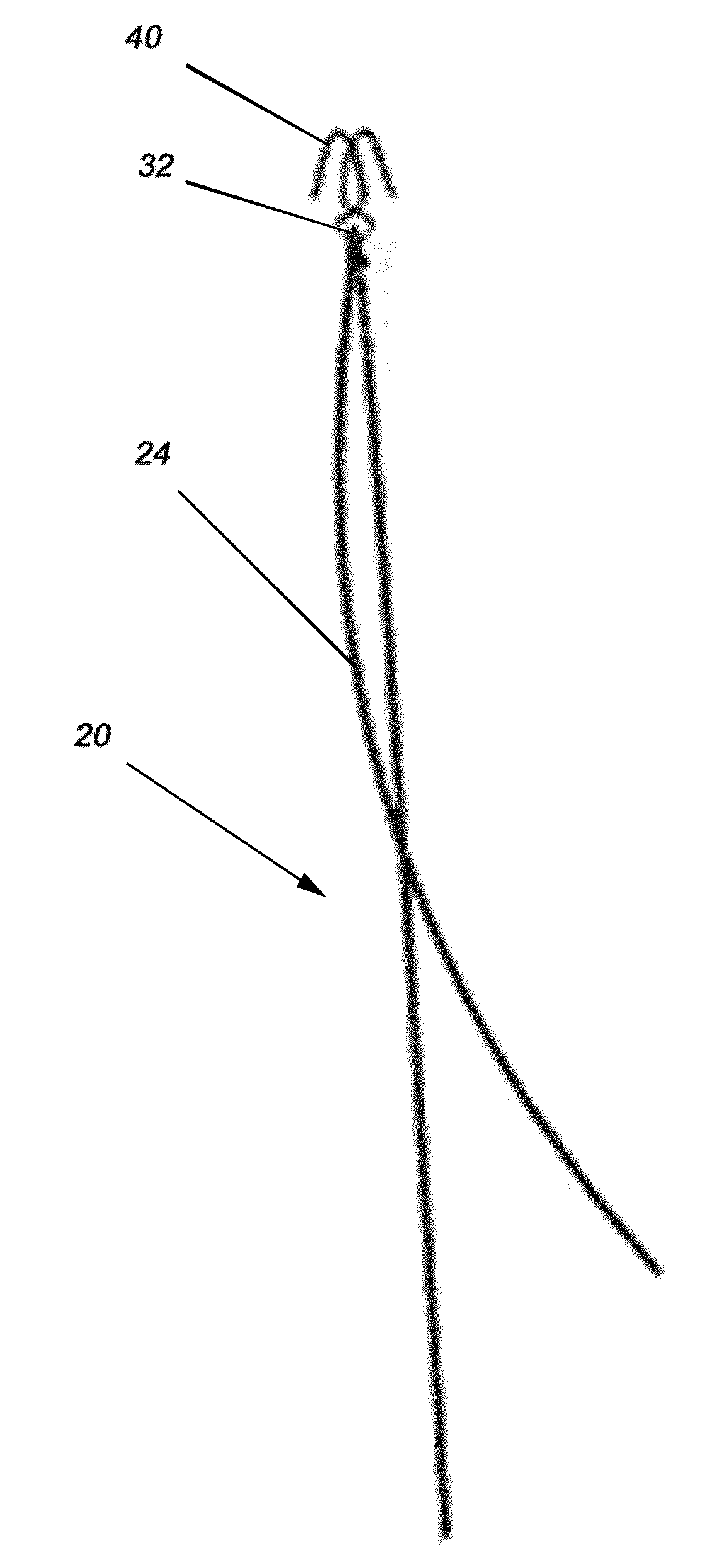 Devices and methods for anterior arytenoid adduction