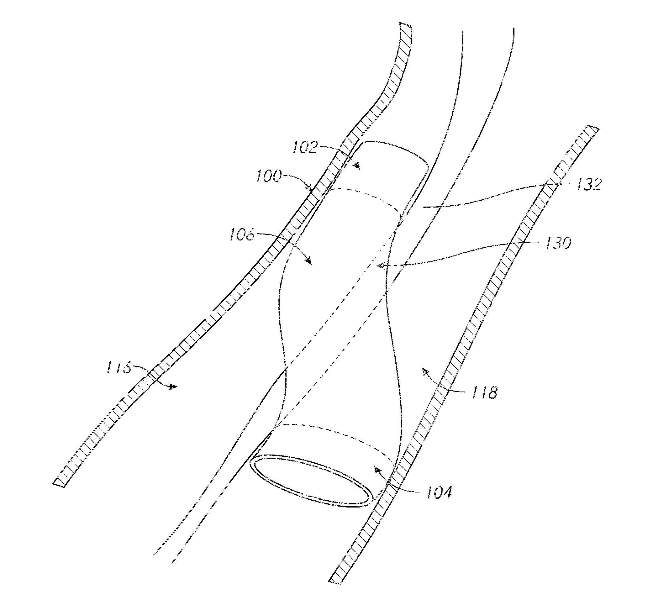 Methods for targeting body passages