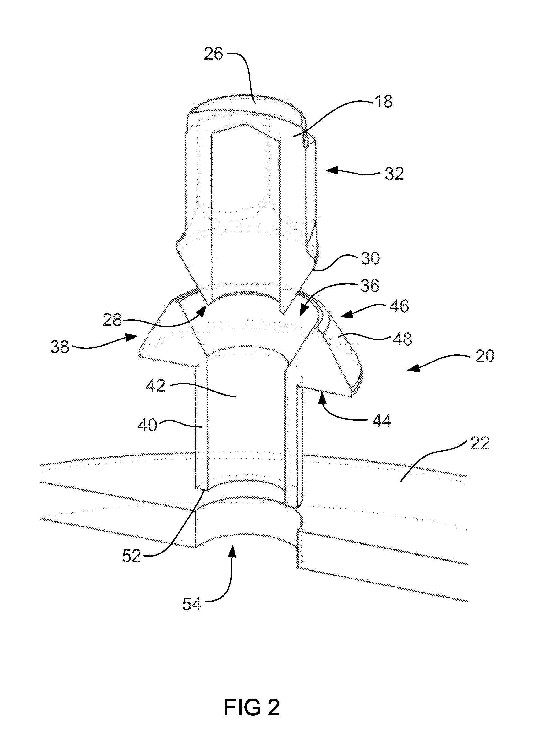 Attachment arrangement for composite wheels