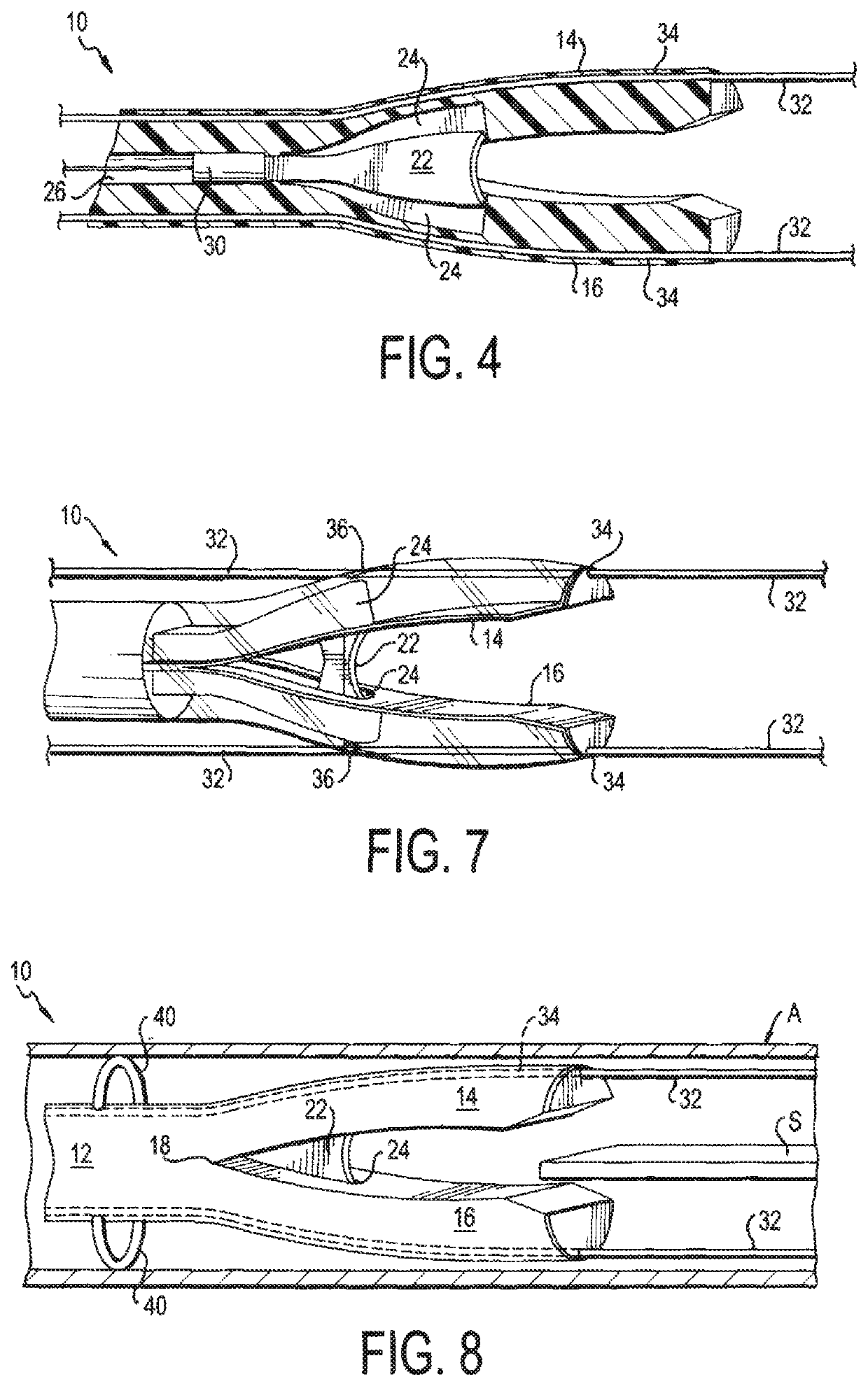 Septotomy Catheter for Aortic Dissection