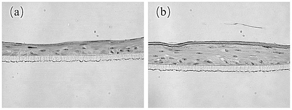 Usnea barbata extract, application thereof and skin external preparation containing same