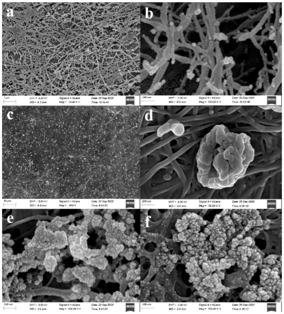 Wound dresing of bacterial cellulose-based sericin and peppermint oil nanoparticle wound dressing and preparation method thereof