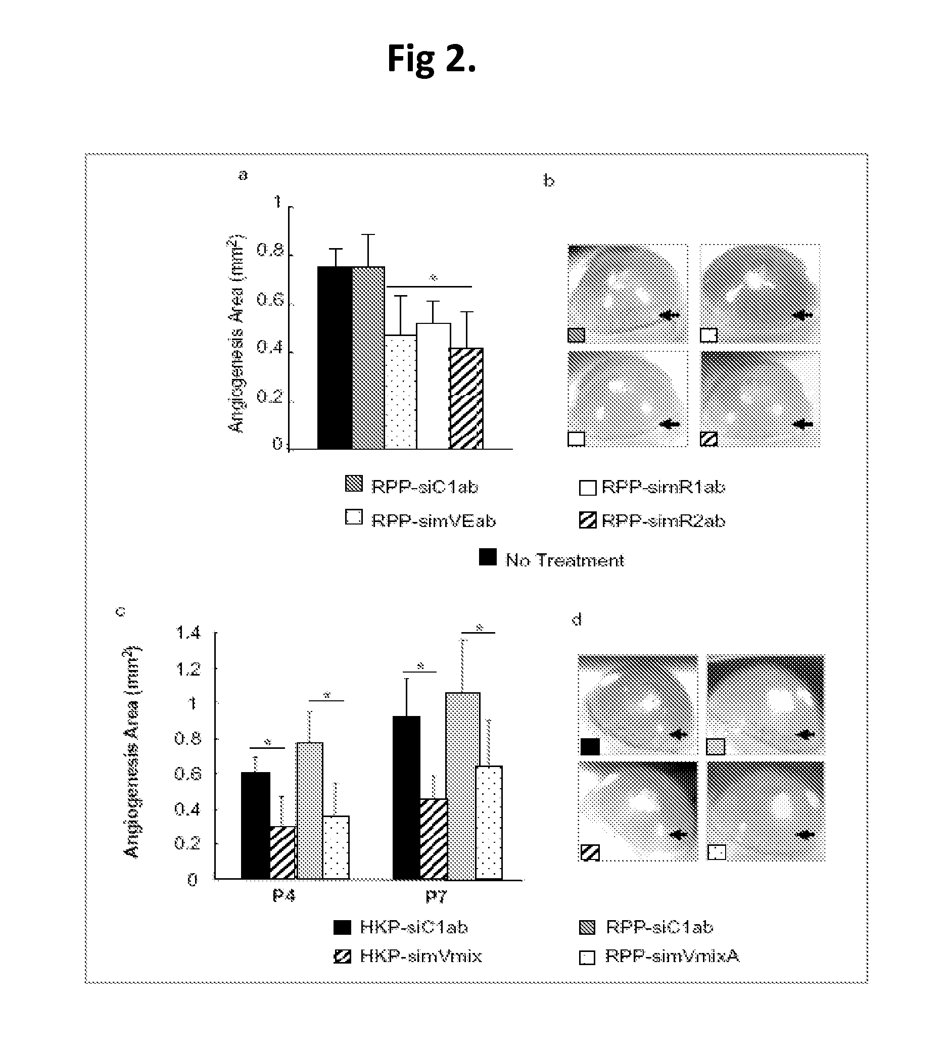 Compositions and methods using siRNA molecules and siRNA cocktails for the treatment of breast cancer