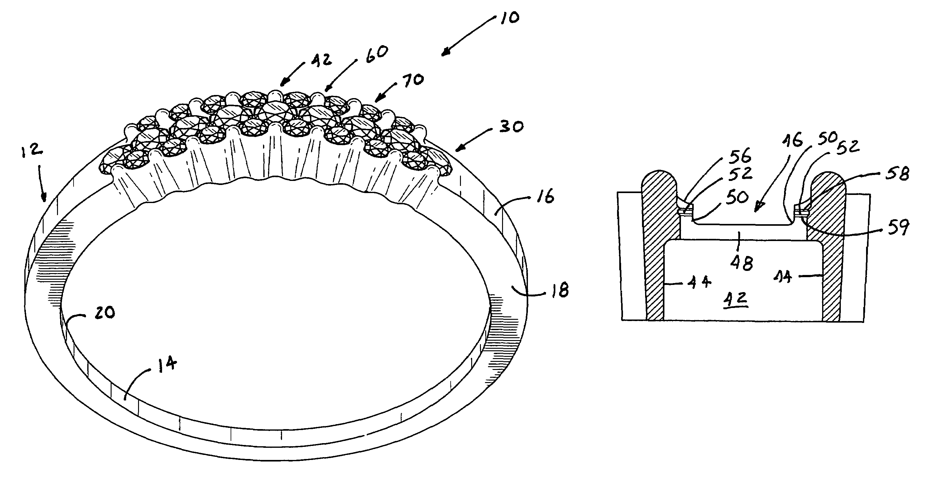 Jewelry article utilizing a linear stone setting