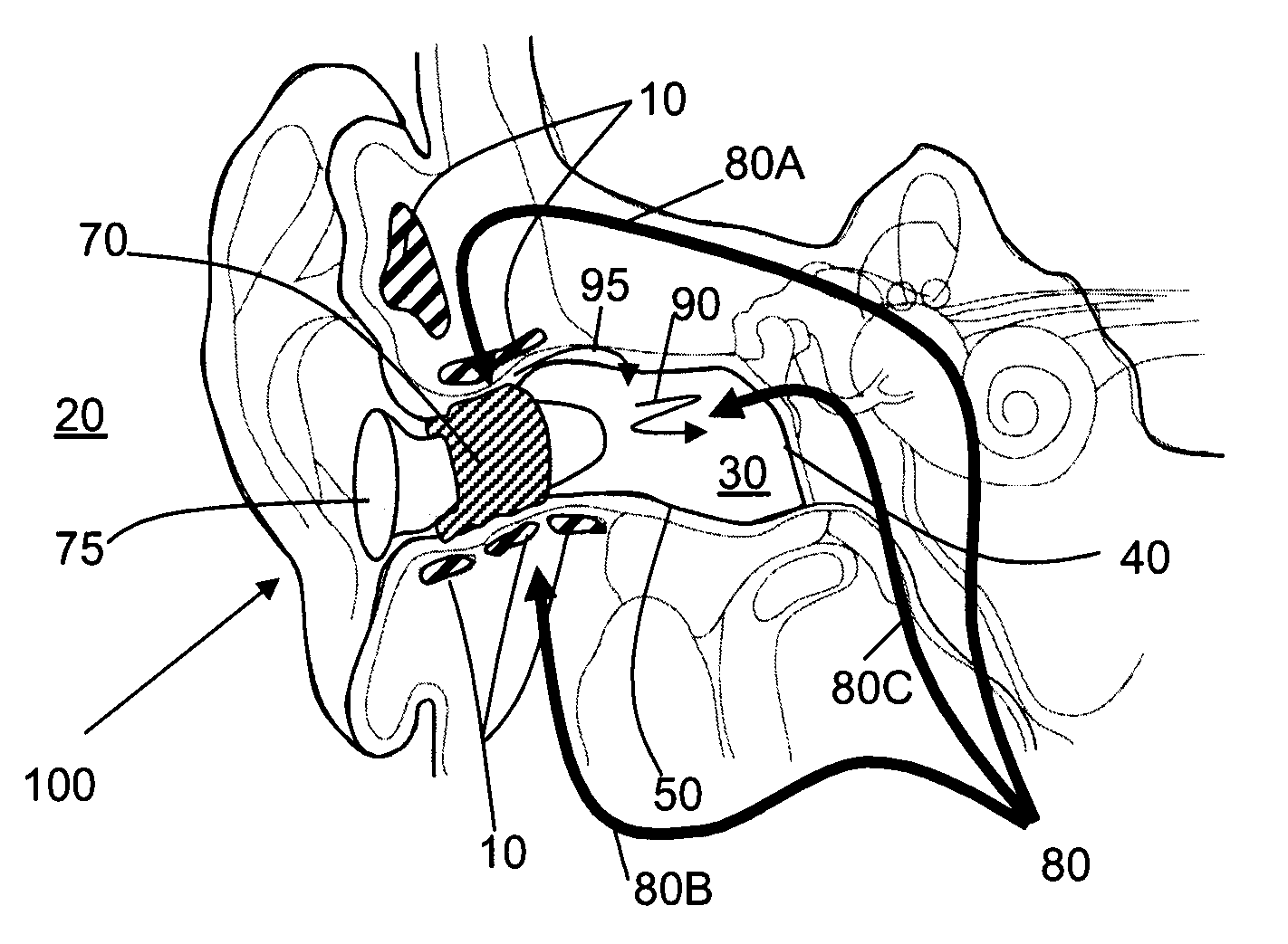 Pressure regulating systems for expandable insertion devices
