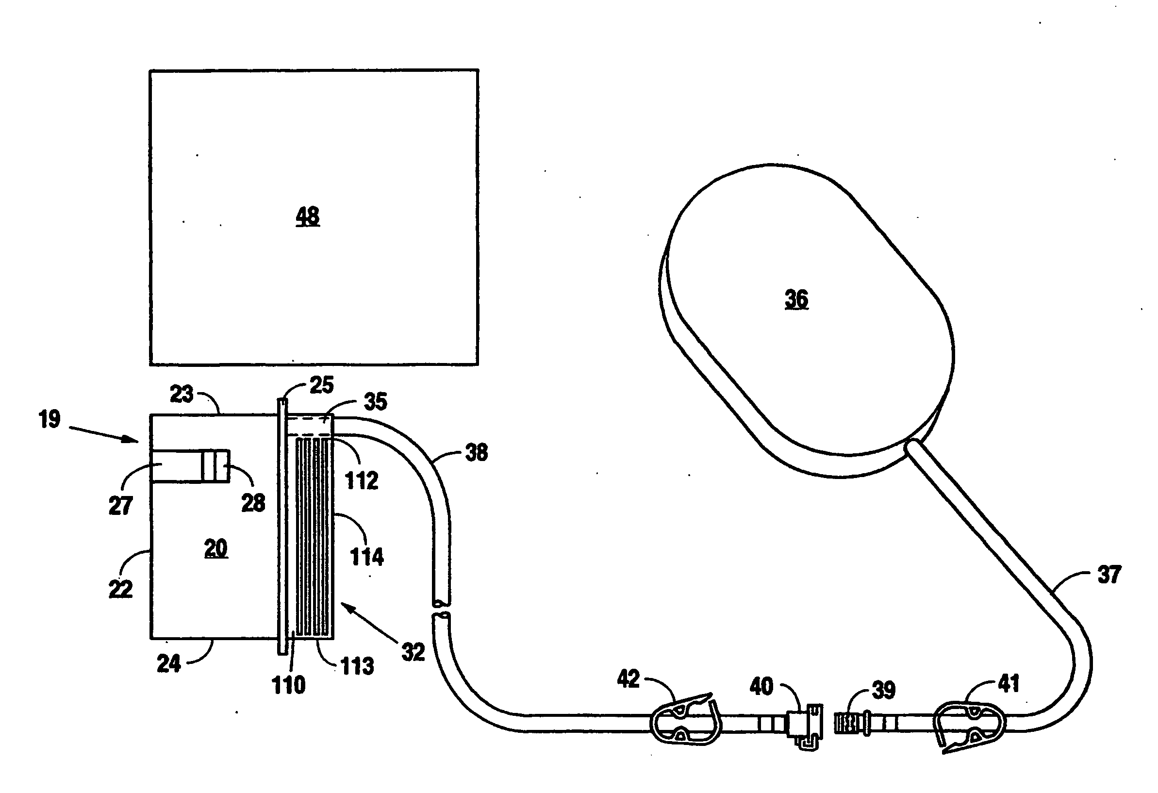 Reduced pressure treatment system having a dual porosity pad