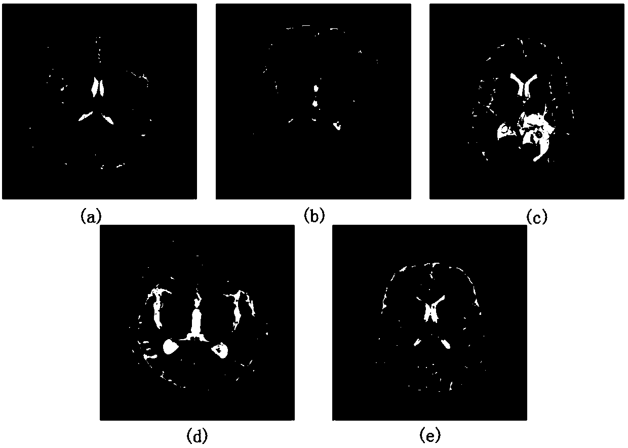 Pathological brain image classification method based on deep stacked sparse autoencoder