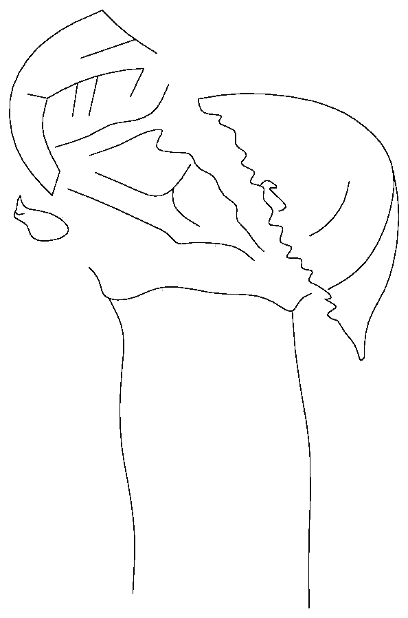 Semi-radius head prosthesis structure