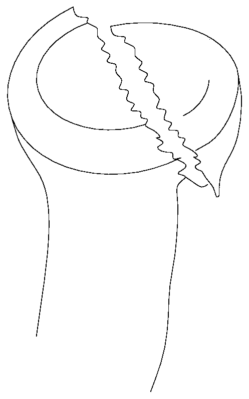 Semi-radius head prosthesis structure