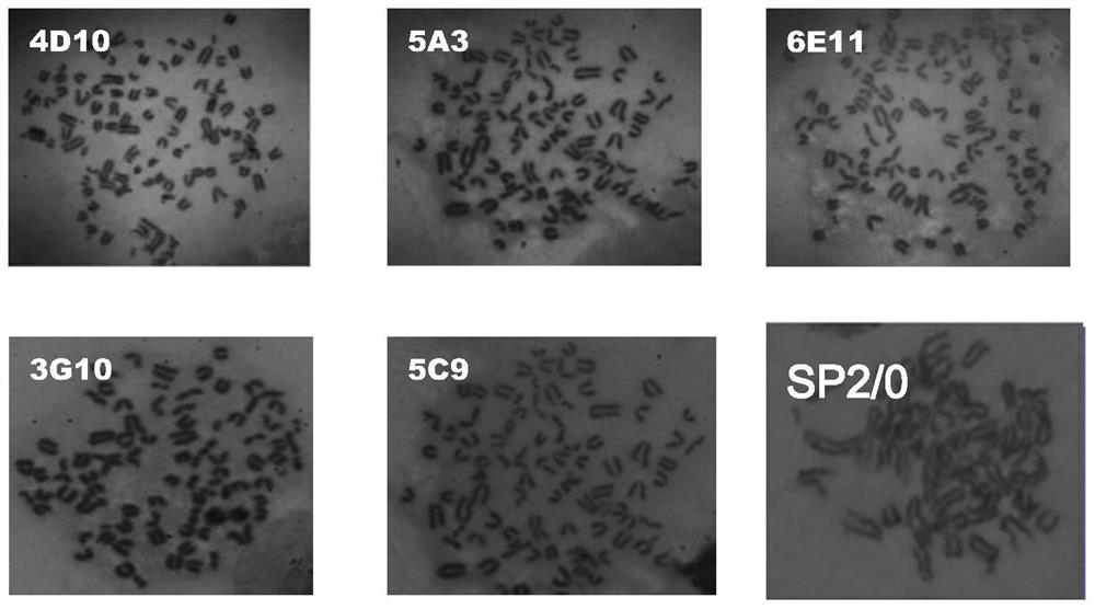 A double-antibody sandwich ELISA diagnostic kit for detecting bovine rotavirus and its application