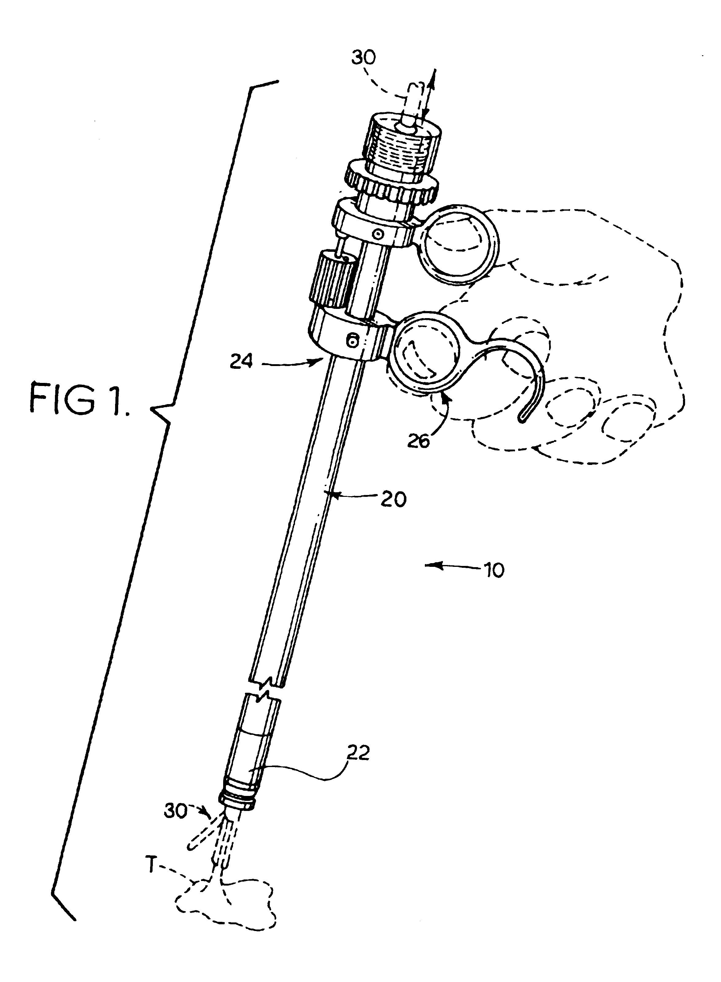 Surgical loop delivery device