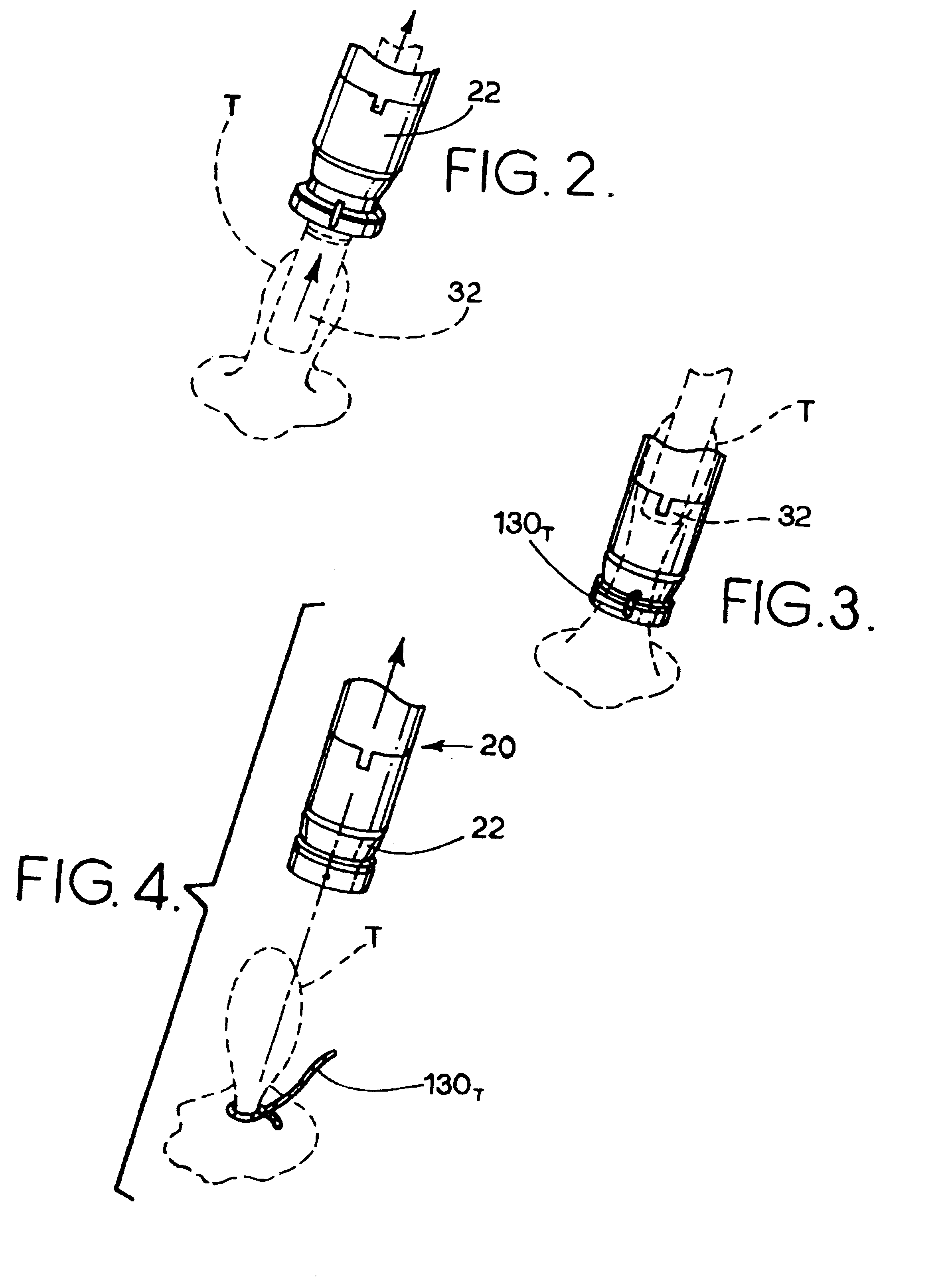 Surgical loop delivery device