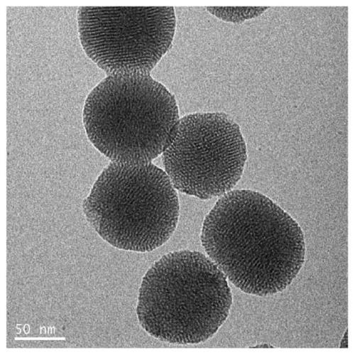 Tumor self-targeting multilevel response type mesoporous silicon drug delivery system and preparation method thereof