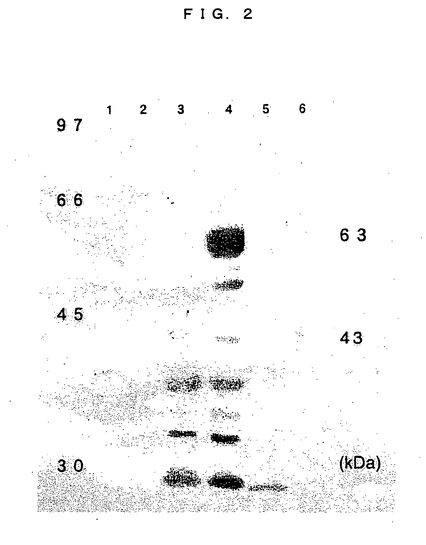 Tick galectin