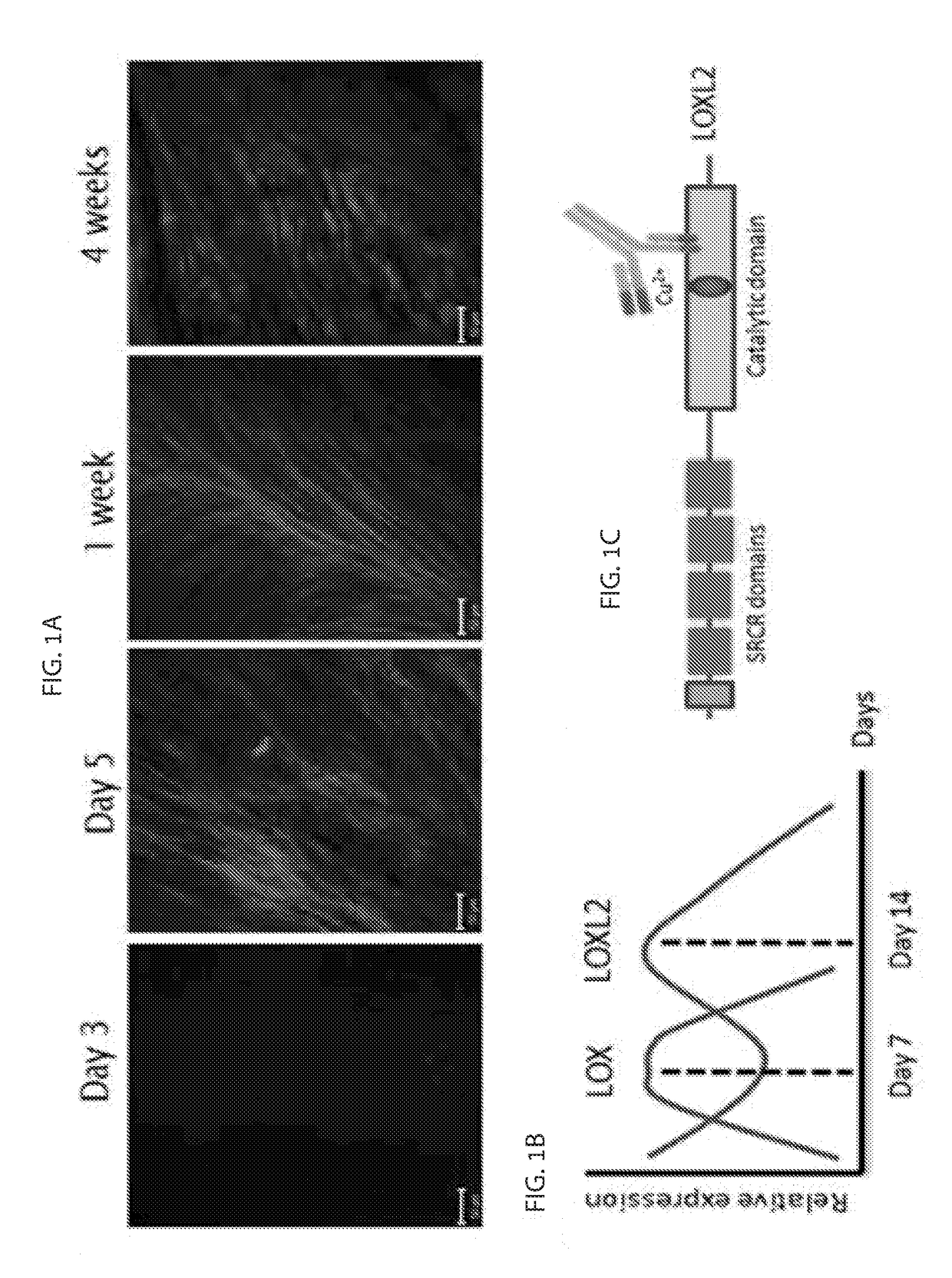 Antibodies targeted against loxl-2 for the treatment of collagen-associated pathologies