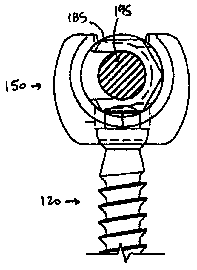 Polyaxial pedicle screw having a rotating locking element