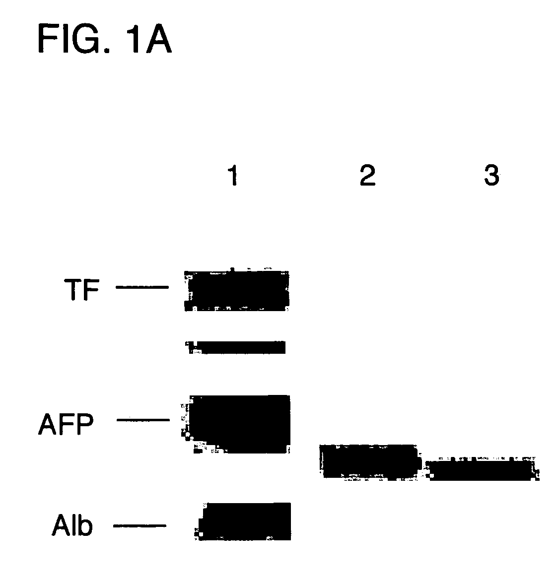 Recombinant human alpha-fetoprotein as an immunosuppressive agent