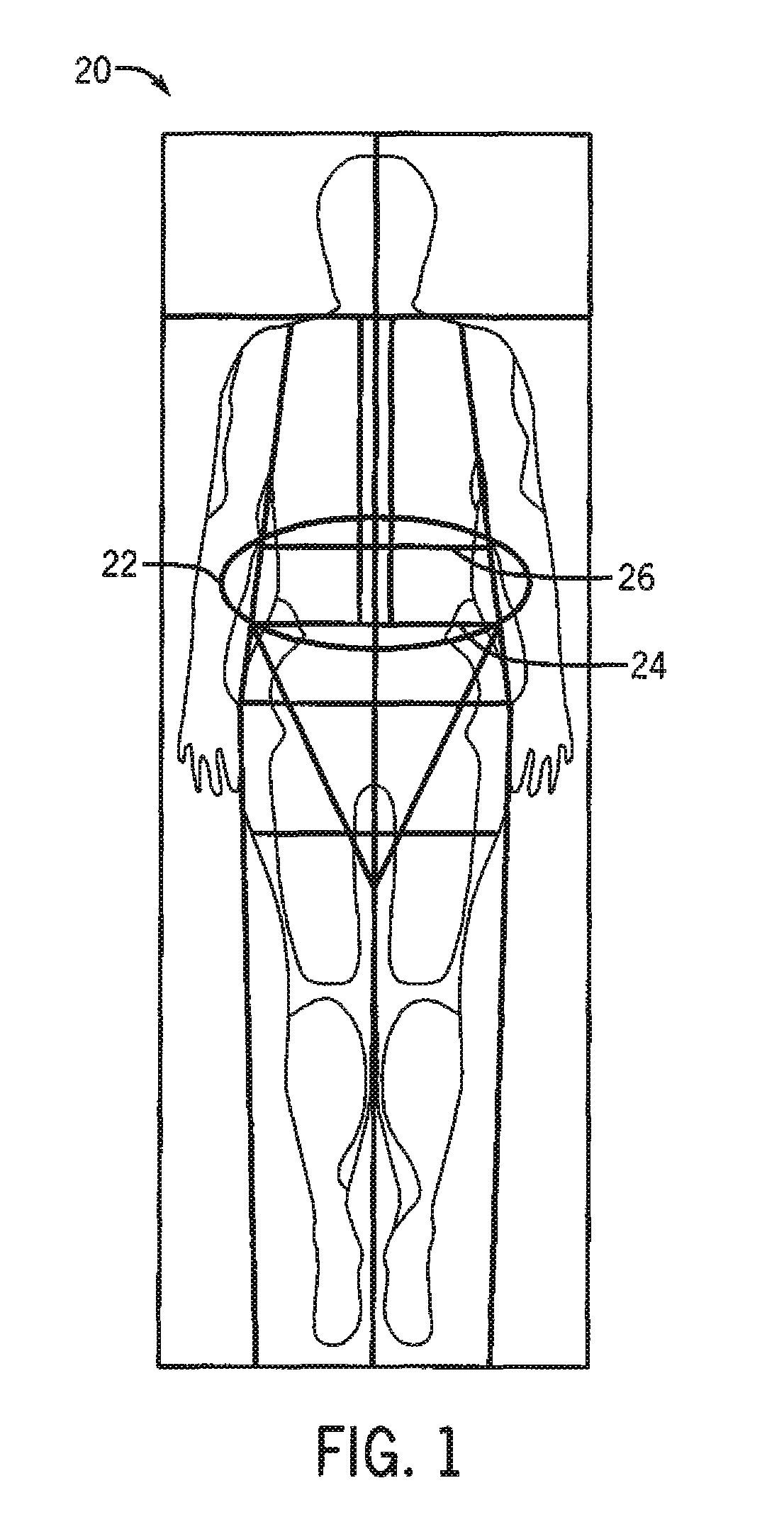 Method and system for measuring visceral fat mass using dual energy x-ray absorptiometry