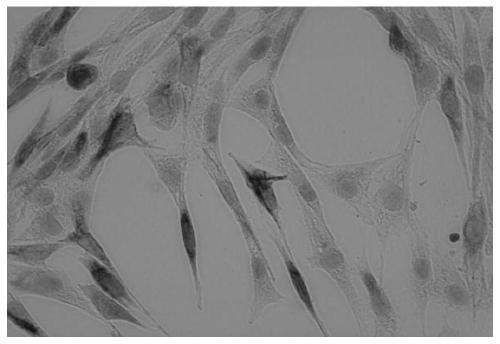 Skeletal muscle stem cell serum-free medium and its preparation method and application