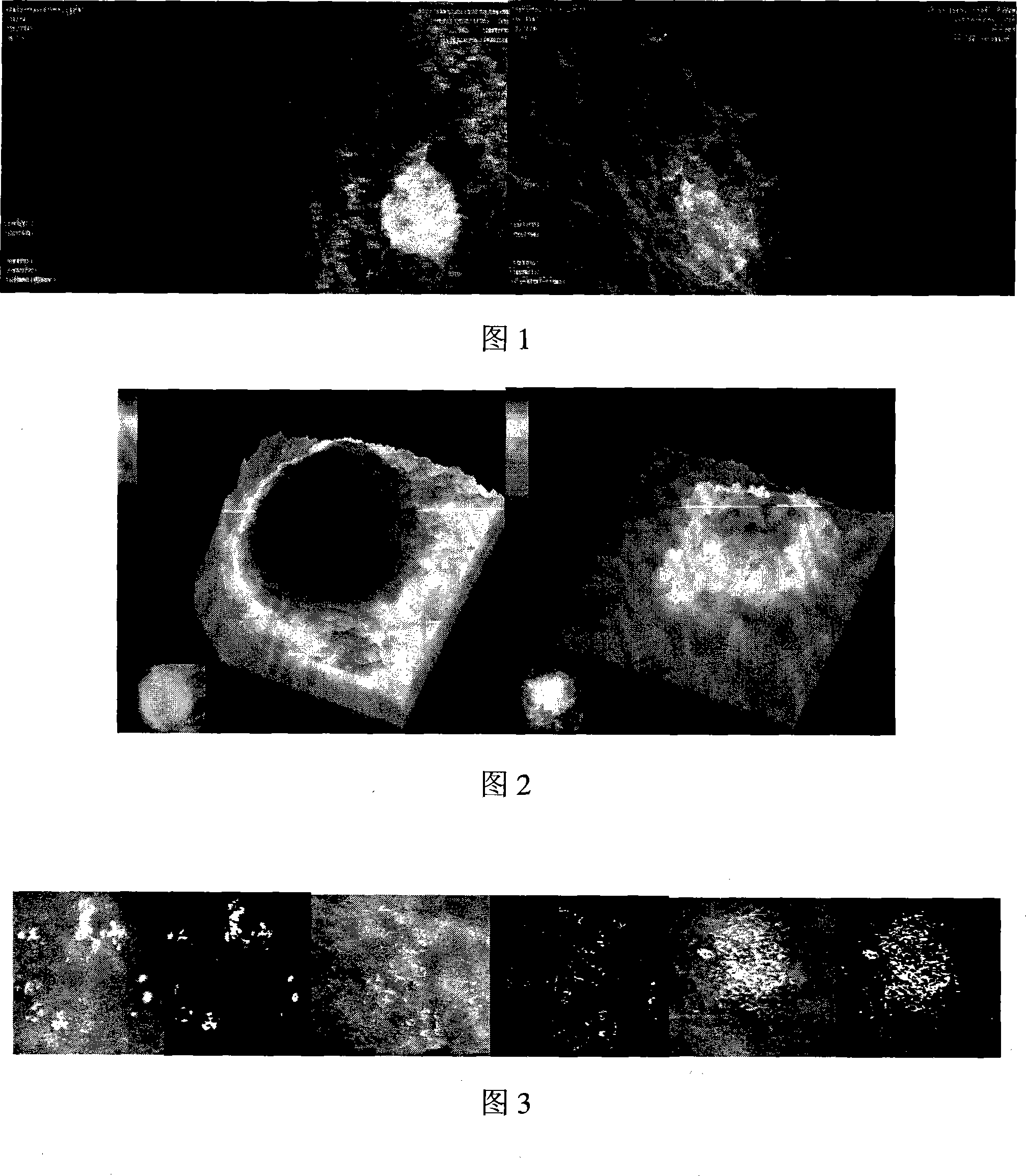 Mammary gland affection quantification image evaluation system and using method thereof
