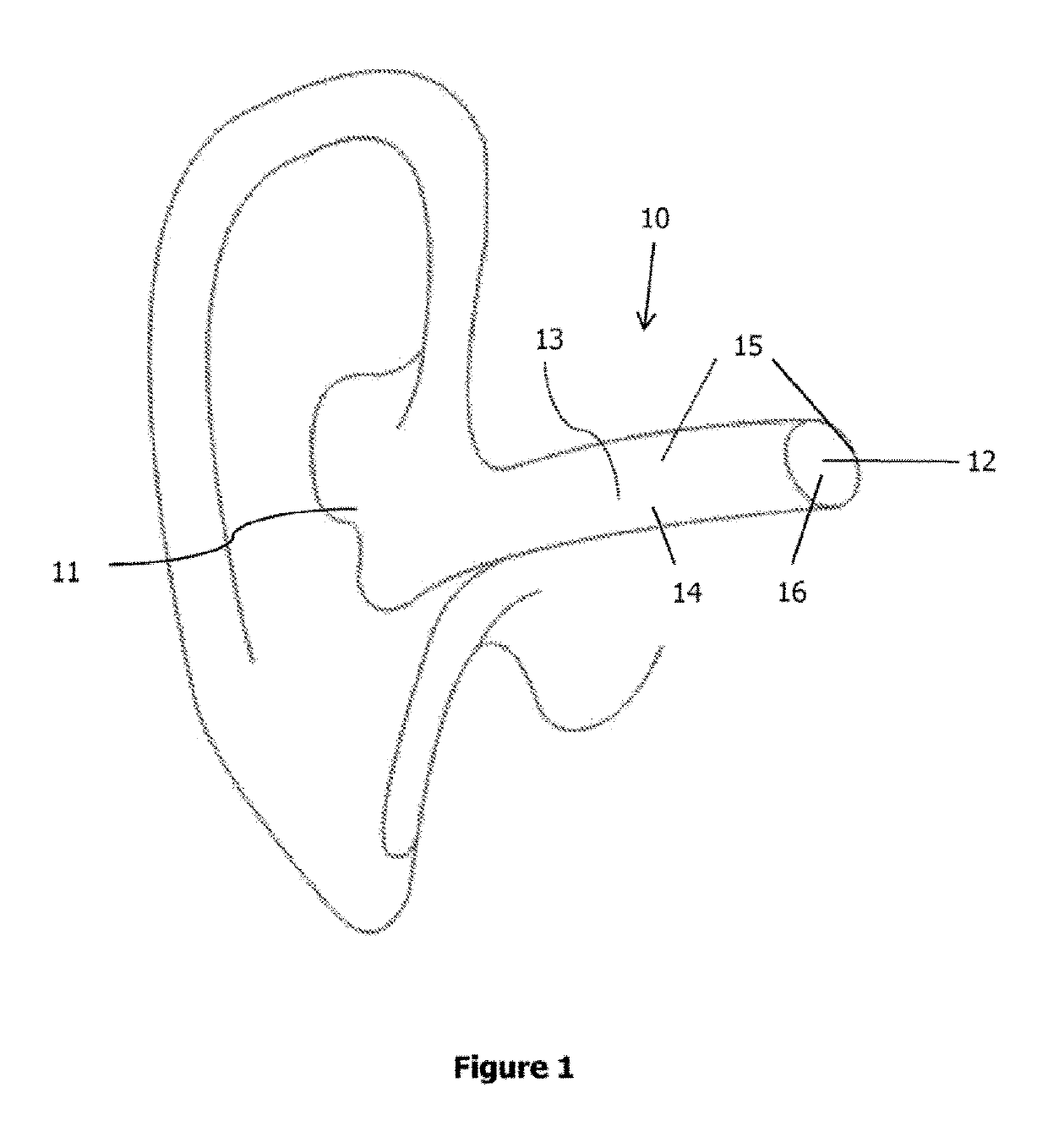 Electro-stimulation device for innervation of the external ear canal