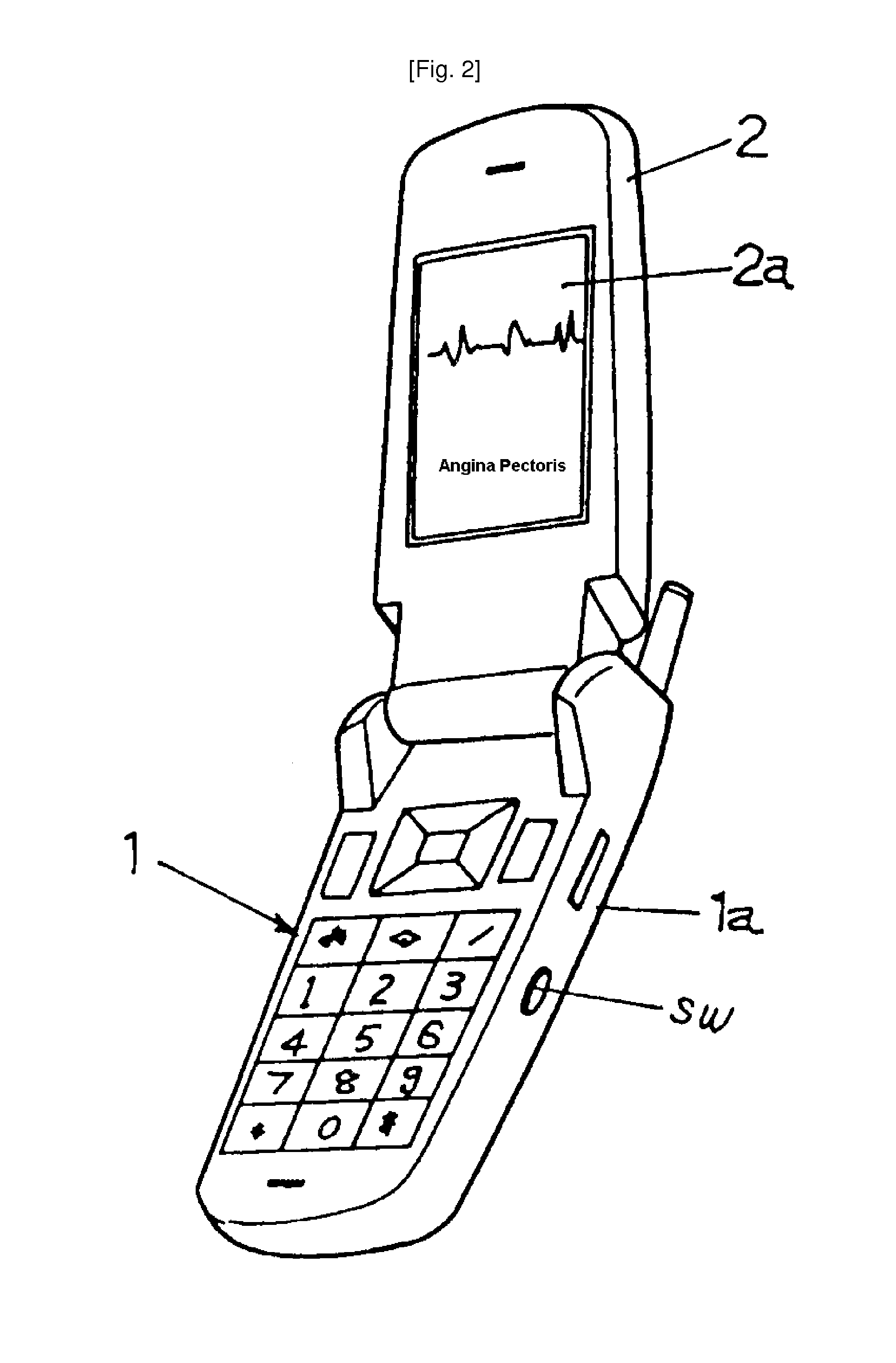 Mobile phone with a stethoscope