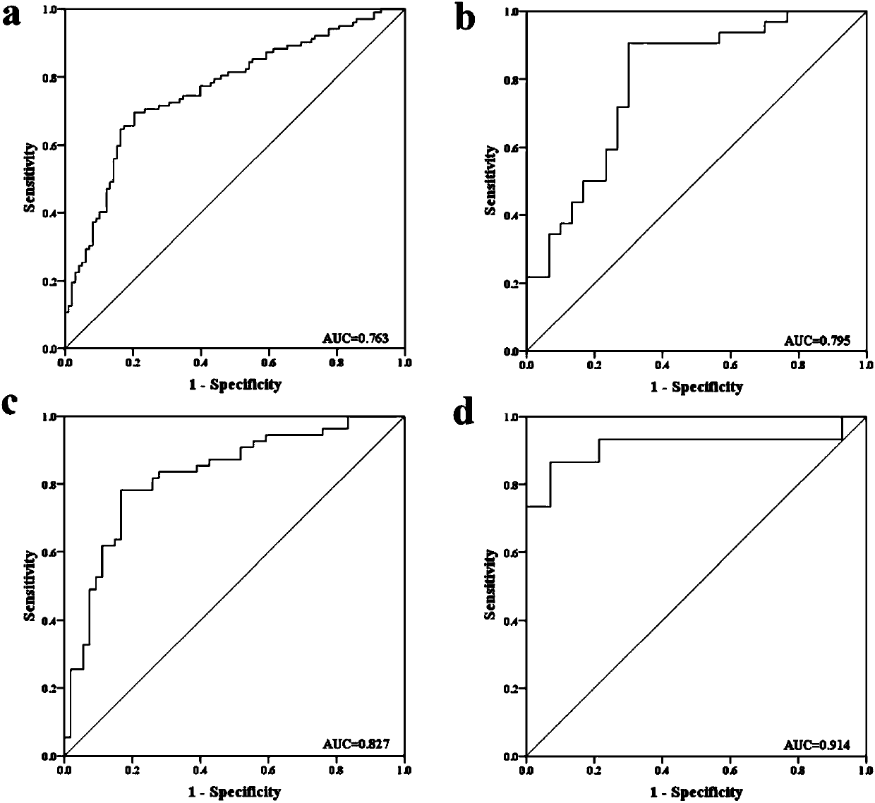 Serum miRNA marker related to squamous cell lung carcinoma auxiliary diagnosis, and application thereof