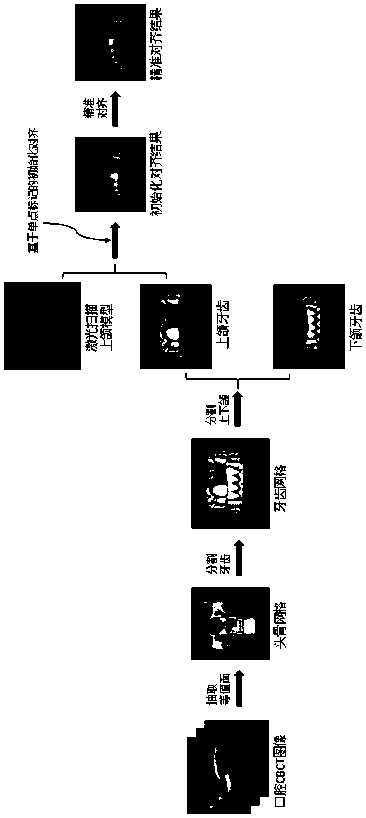 Data Fusion Method of Oral CBCT Image and Laser Scanning Teeth Mesh