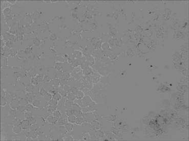 In-situ hybridization assay kit for mRNA level of premalignant CDK8 (cyclin-dependent kinase 8) as well as assay method and application