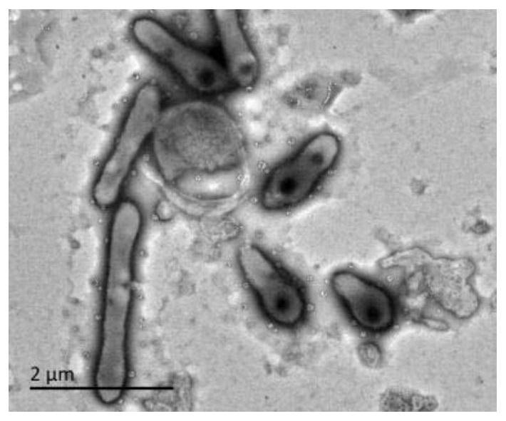 Nitrilase xinit1 and its coding gene and application