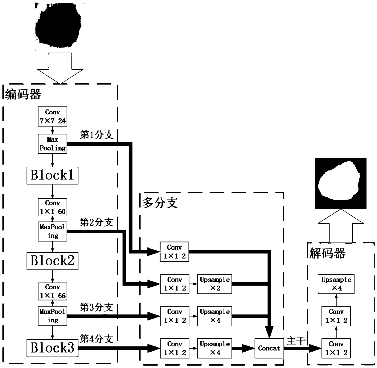 A dermatoscope image segmentation method based on a multi-branch convolutional neural network