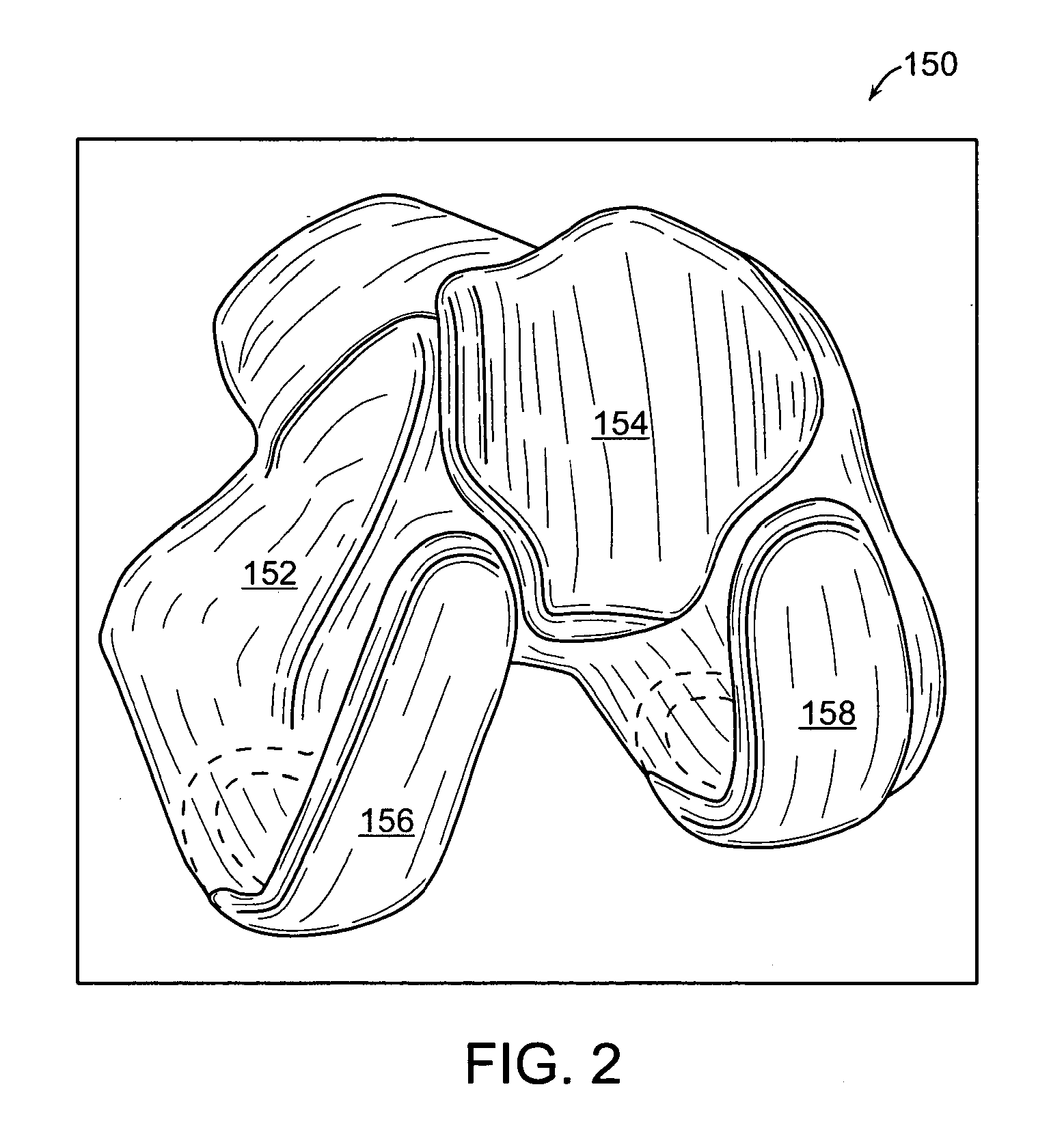 Implant Planning for Multiple Implant Components Using Constraints