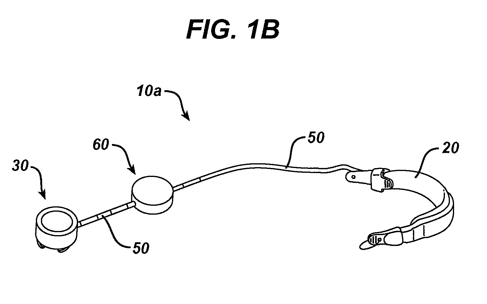 Methods and devices for predicting performance of a gastric restriction system