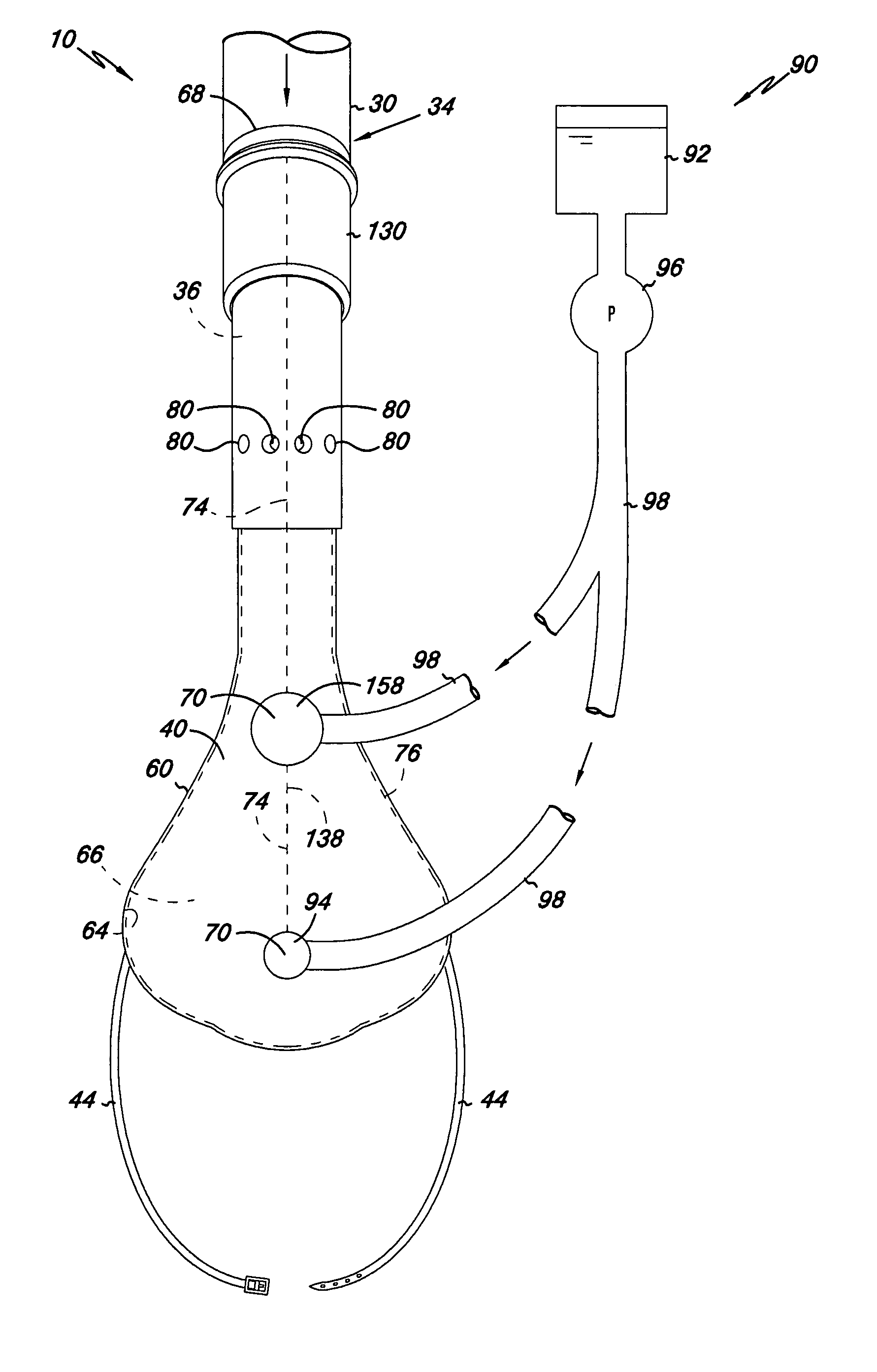 Apparatus and methods for providing humidity in respiratory therapy