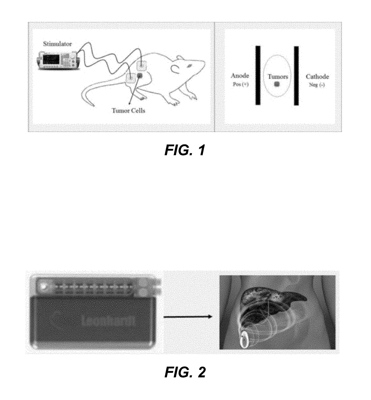 Tumor therapy