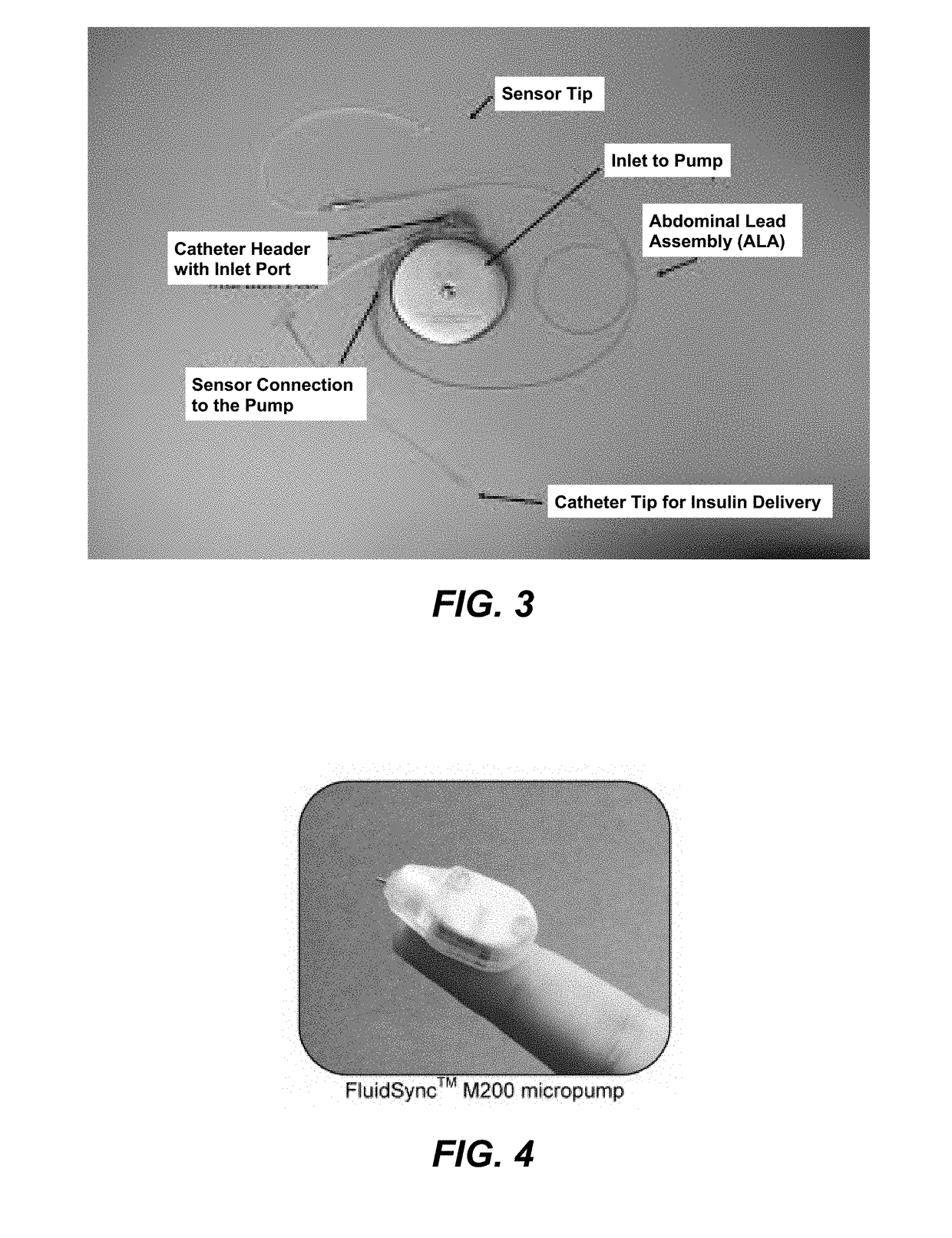 Tumor therapy