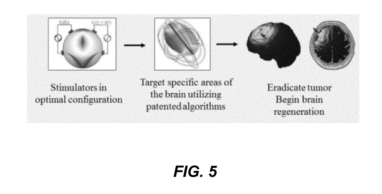 Tumor therapy