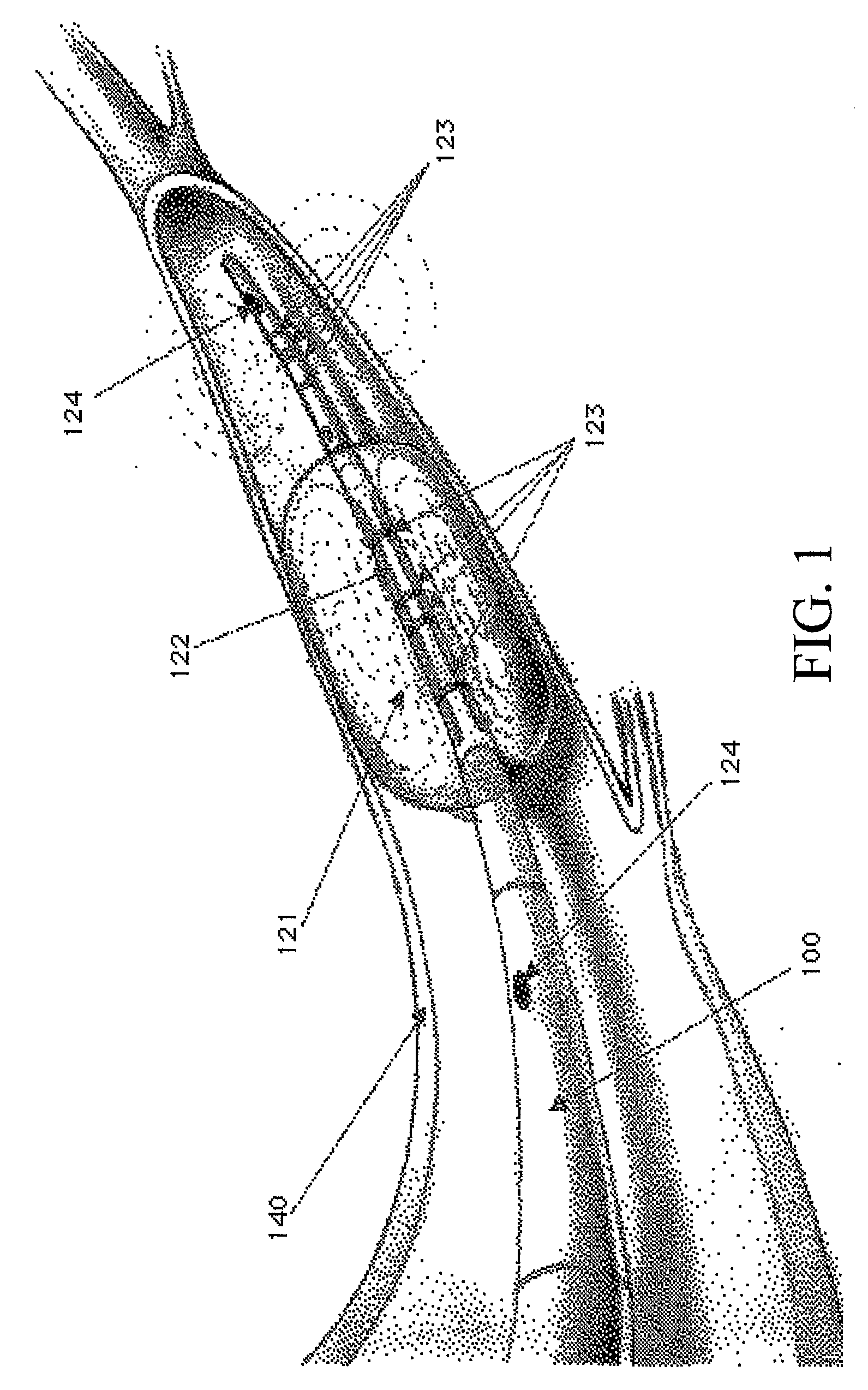 Device and Methods for Controlling Blood Perfusion Pressure Using a Retrograde Cannula