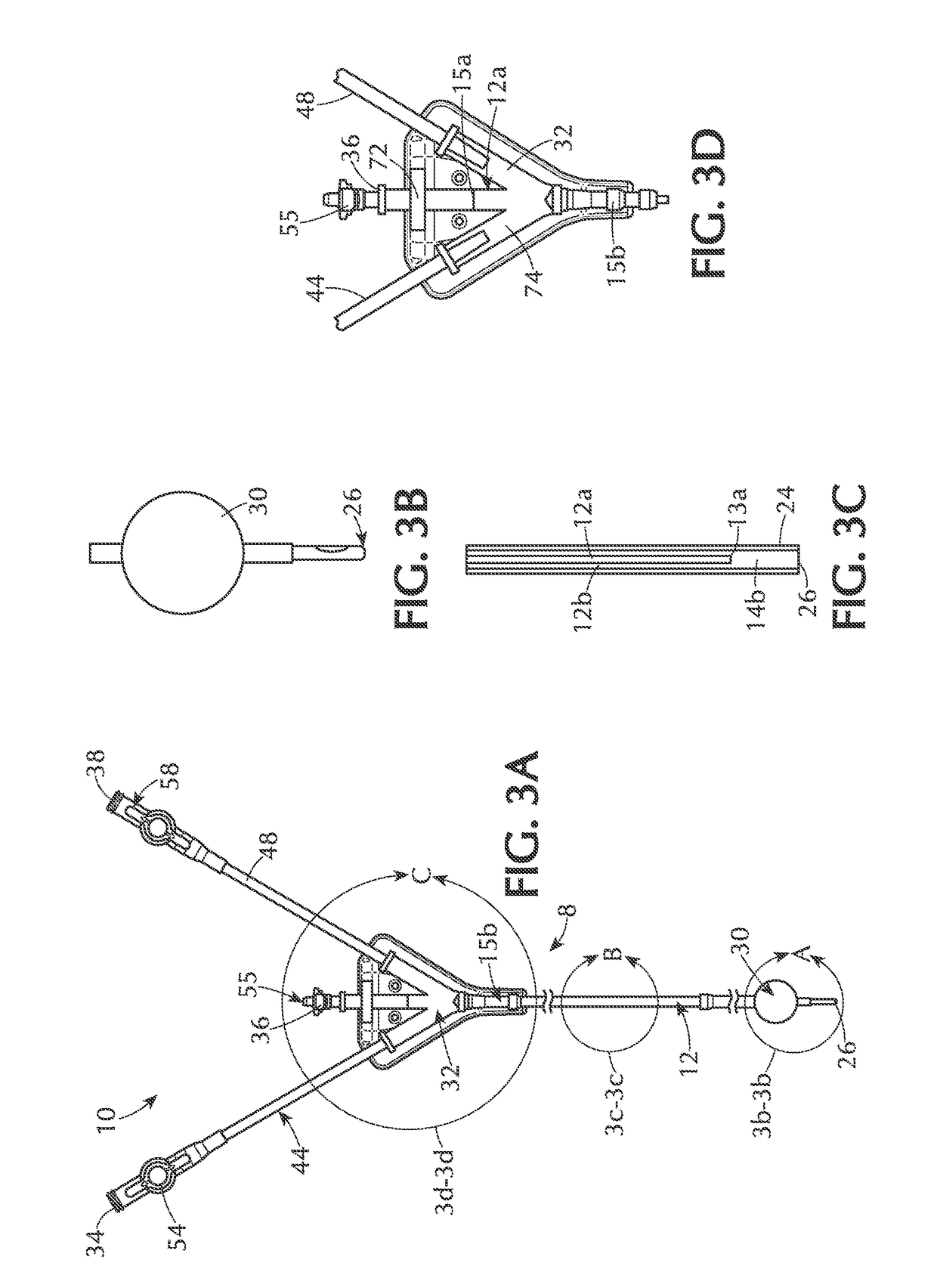 Method and apparatus of echogenic catheter systems