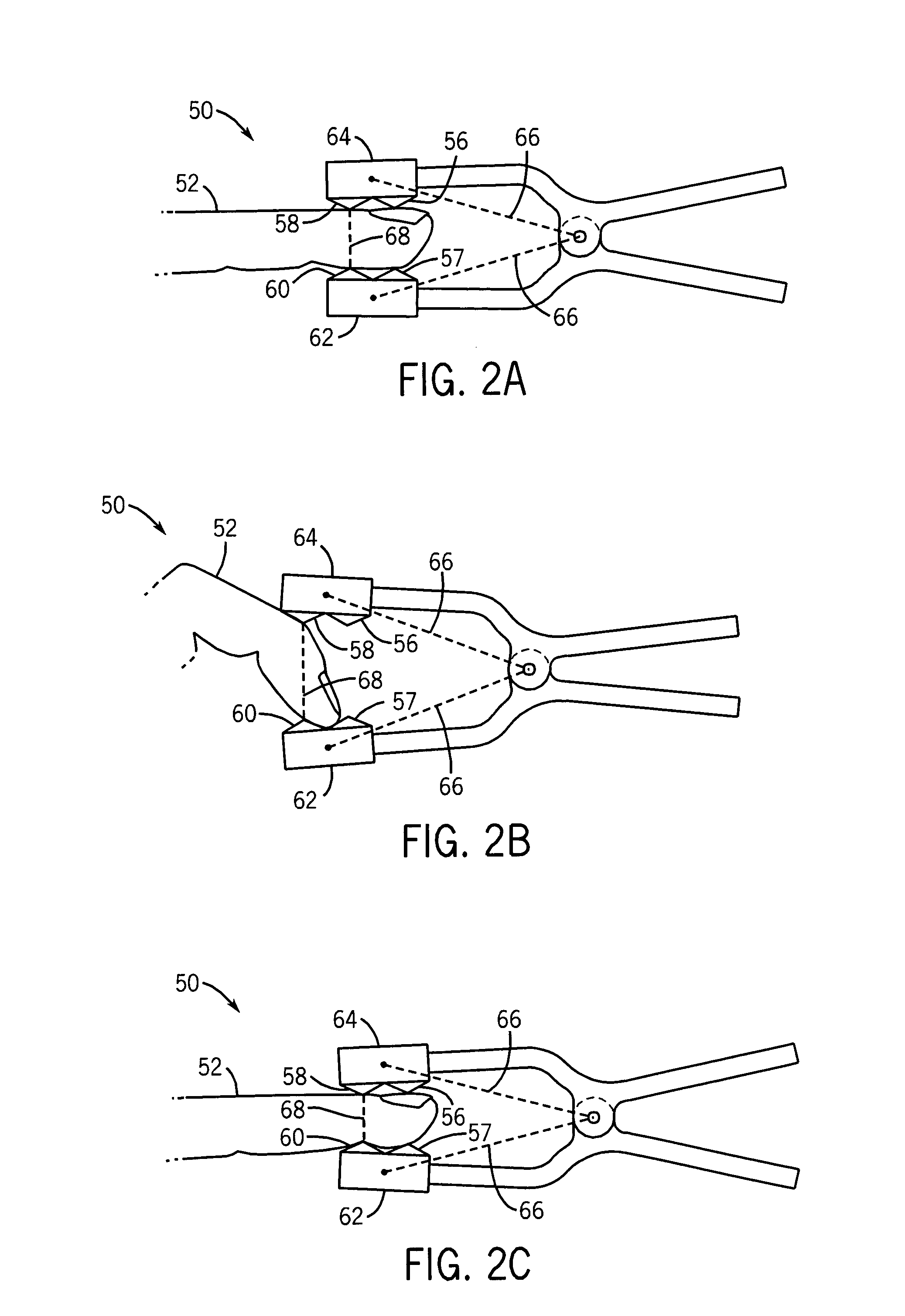 System and method for mitigating interference in pulse oximetry