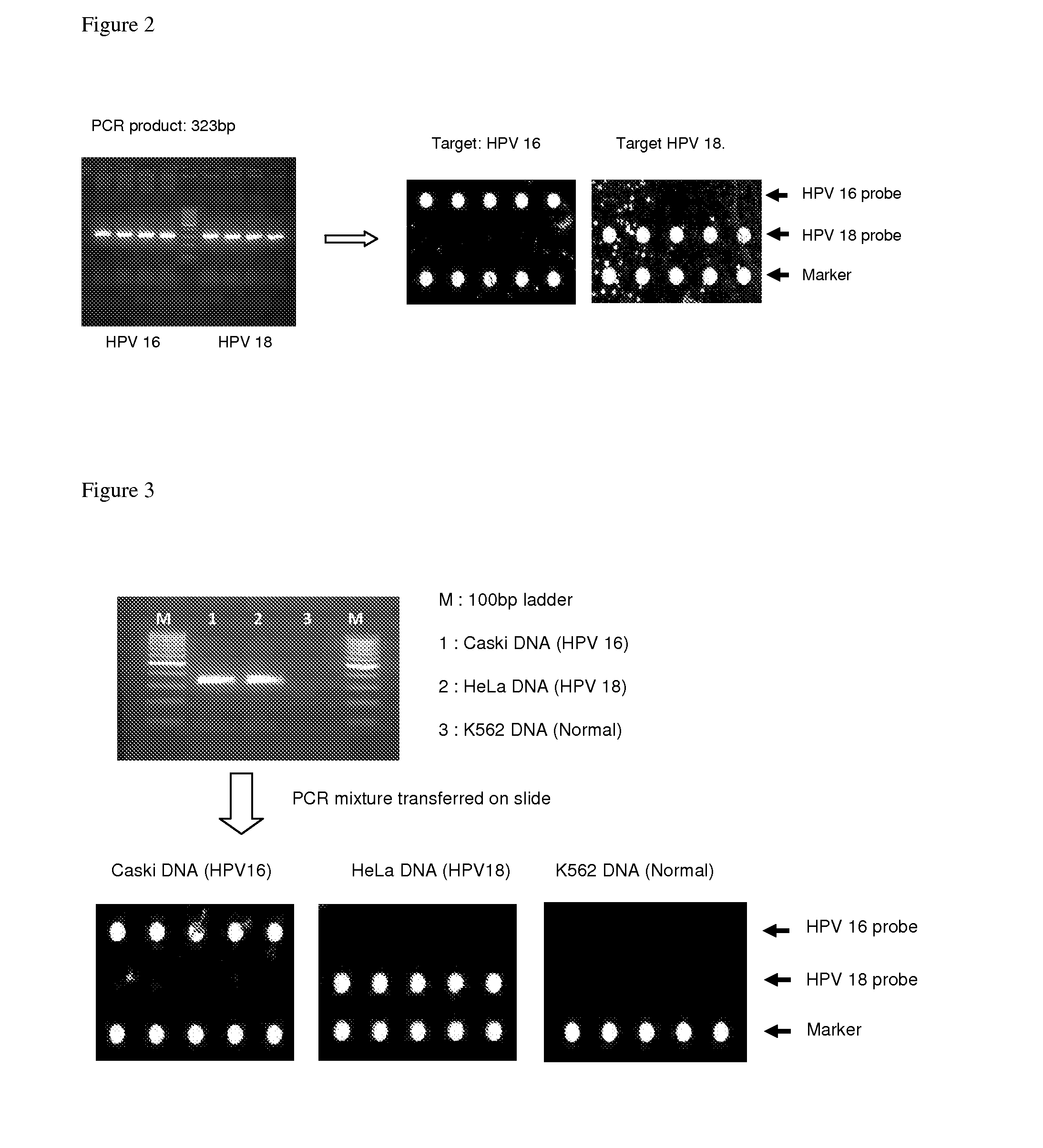 DNA virus detection by DNA chip