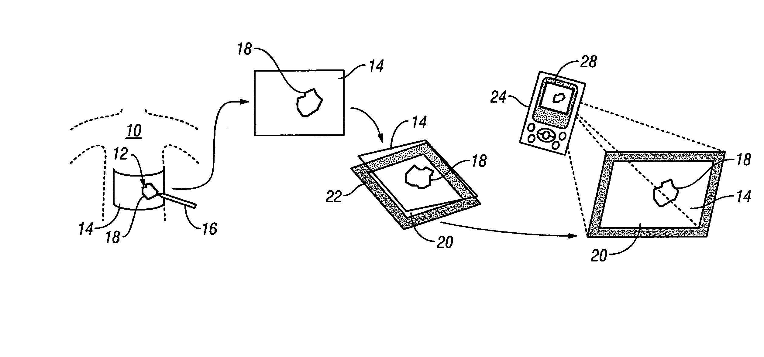 System and method for tracking healing progress of a wound