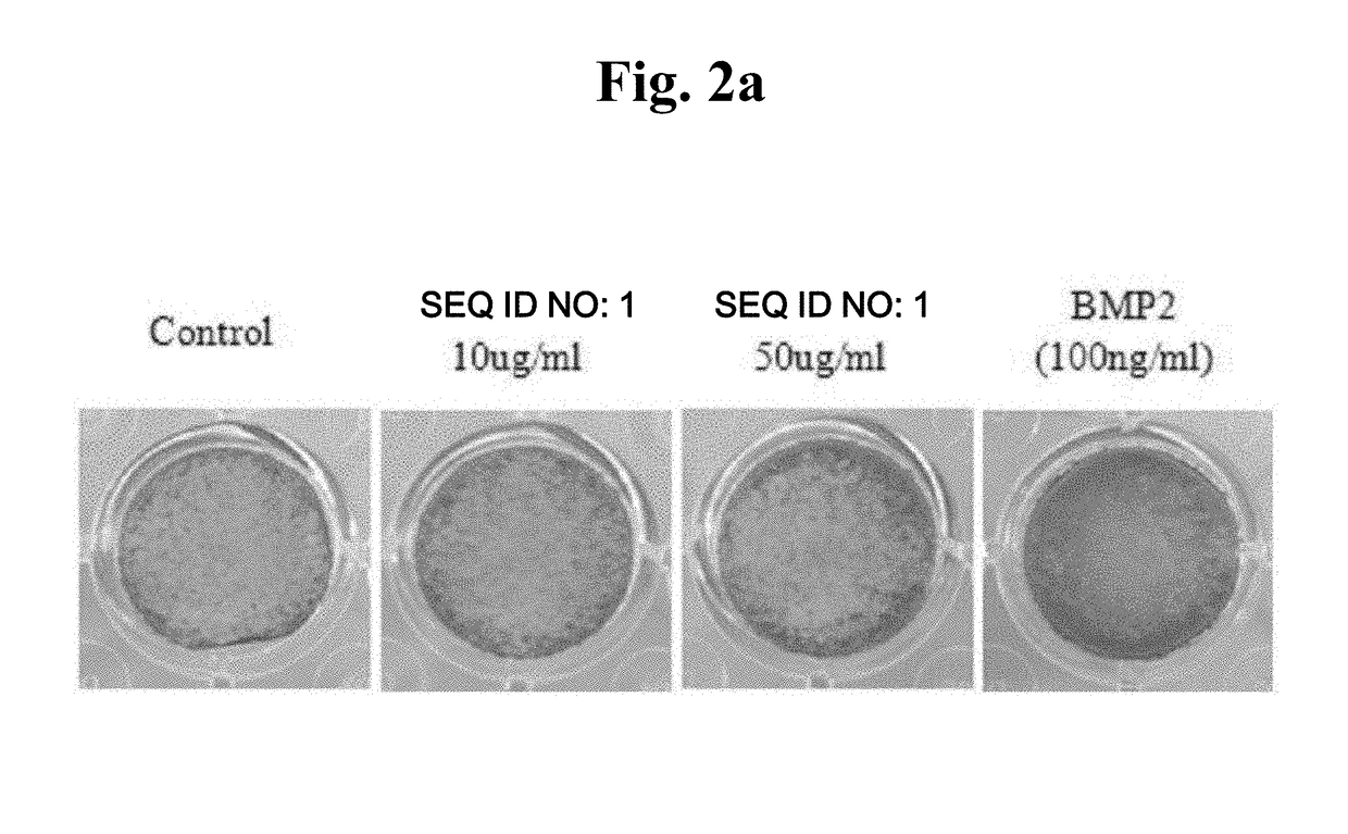 Peptide having osteogenic differentiation promotion and periodontal ligament fibroblast activation promotion, and use of same