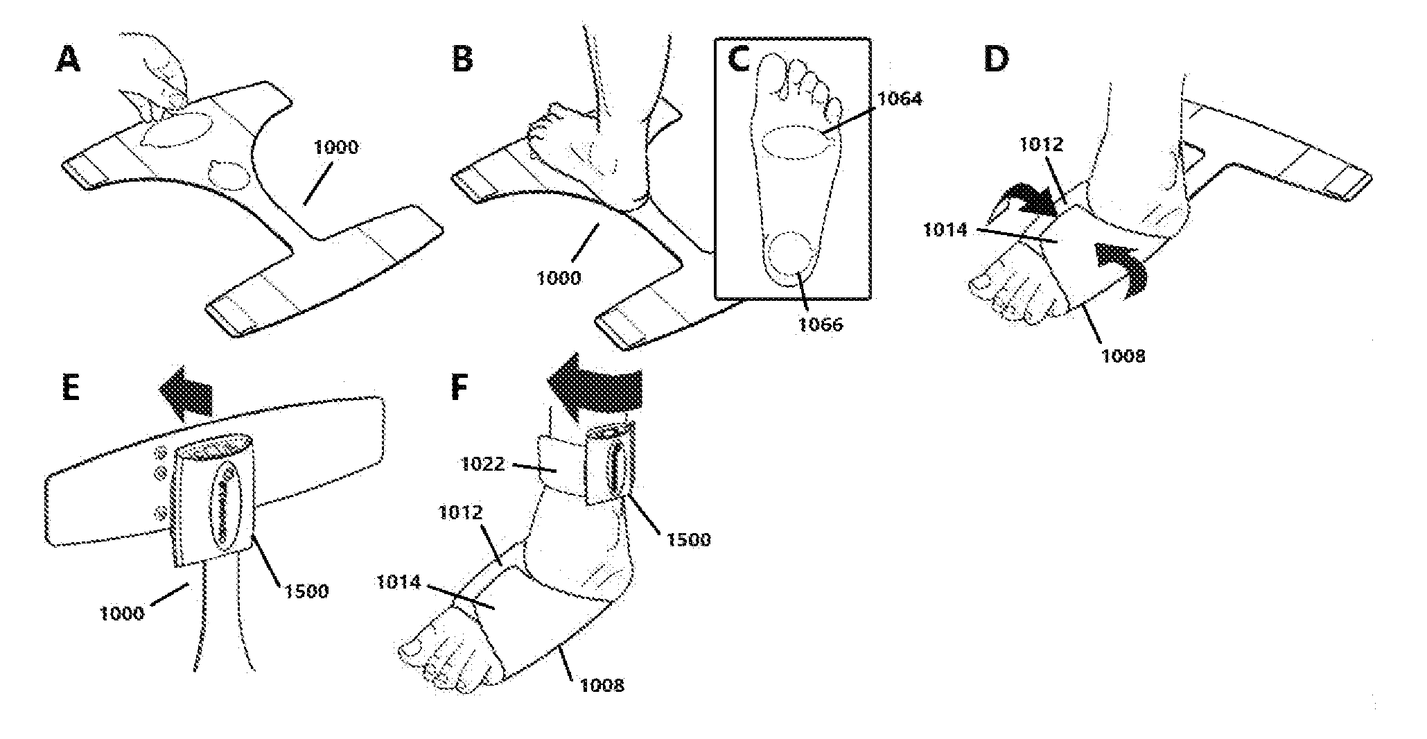 Method and apparatus for noninvasive inhibition of deep vein thrombosis