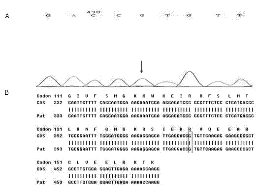 Kit for detecting polymorphism of VKORC1 and CYP2C9 genes