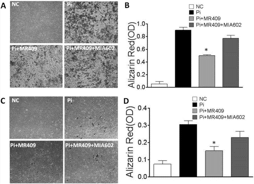 Applications of growth hormone release hormone agonist in preparation of anti-vascular calcification drugs