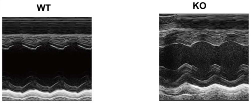 Construction method and application of Tecrl knockout mouse model