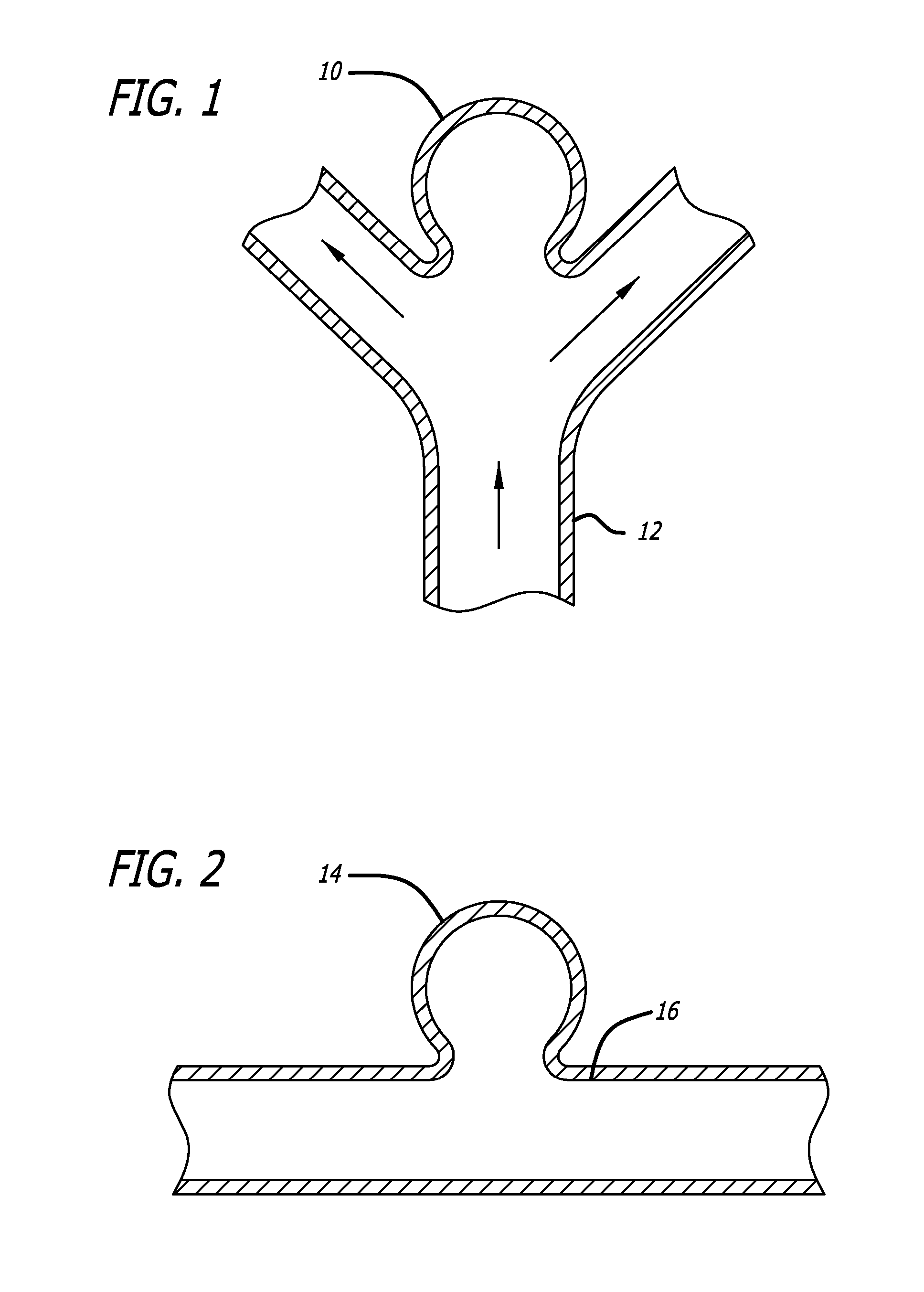 Methods and devices for treatment of vascular defects