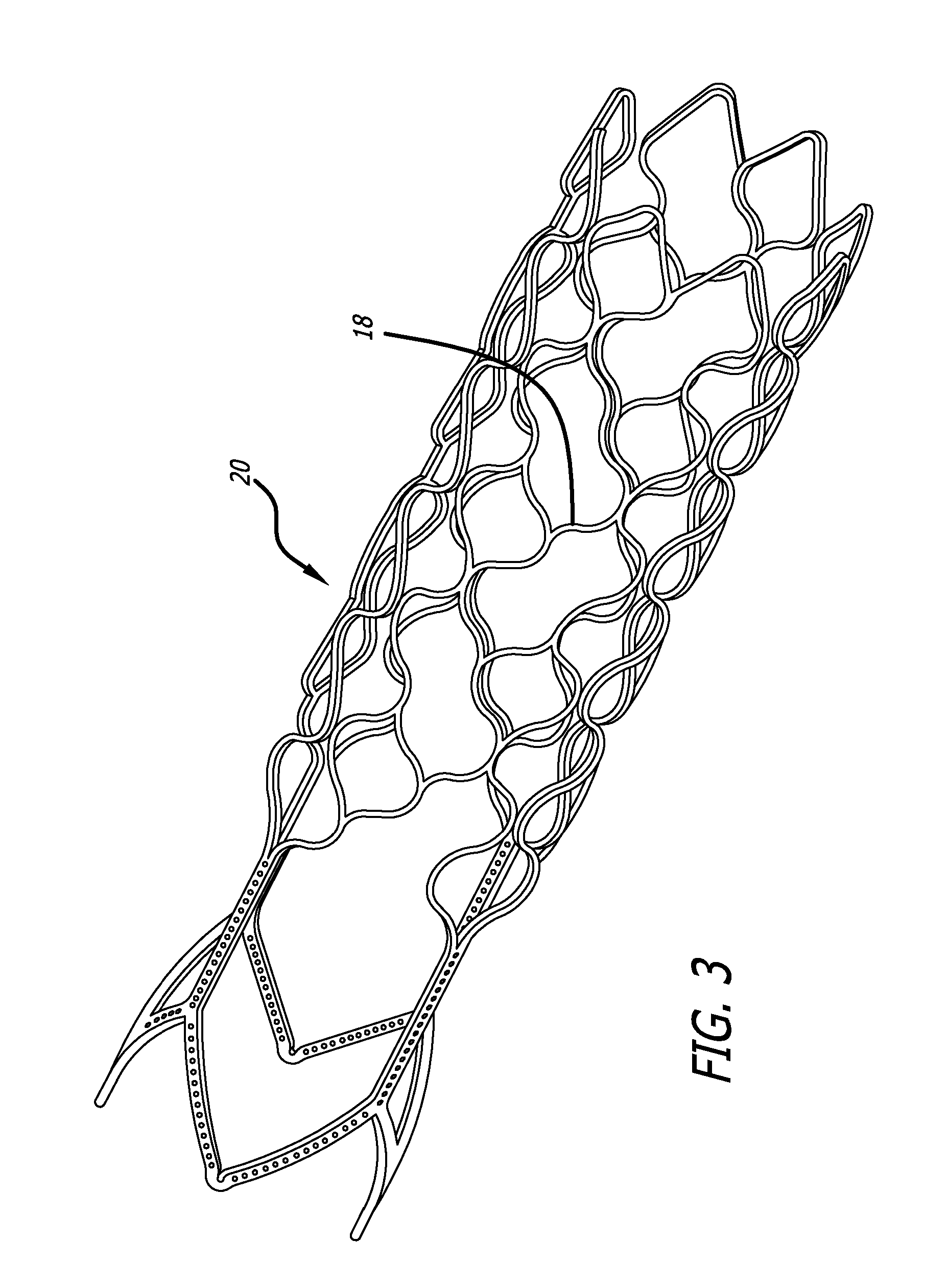 Methods and devices for treatment of vascular defects